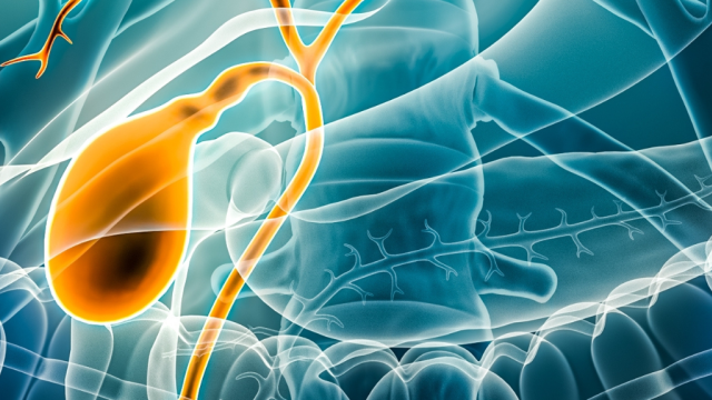 Χοληδόχος Κύστη και Πολύποδες: Διάγνωση και θεραπεία