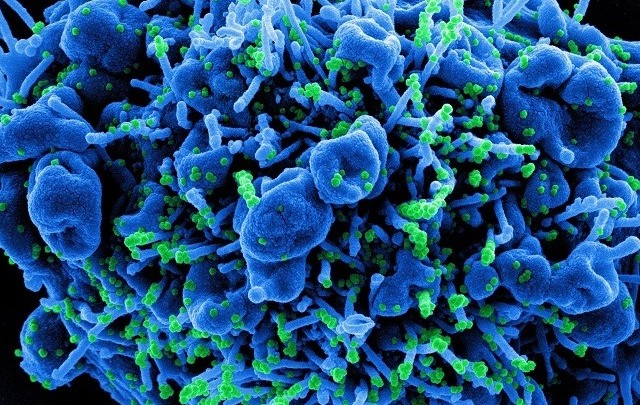 Κορονοϊός: 484 νέα κρούσματα, 255 διασωληνωμένοι, 17 θάνατοι