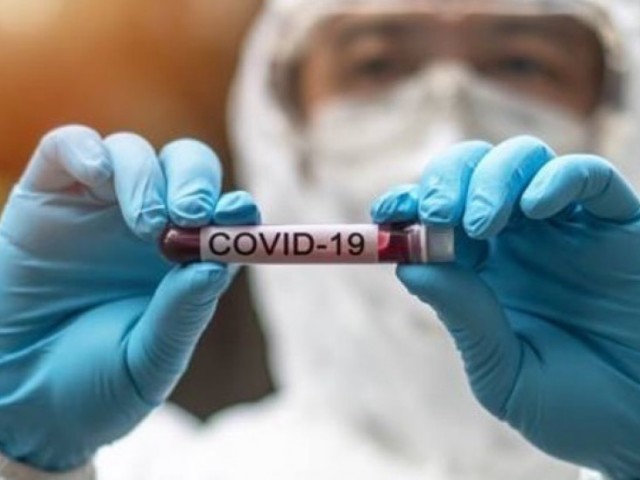 Κορονοϊός: 1.269 νέα κρούσματα, 36 θάνατοι και 391 διασωληνωμένοι 