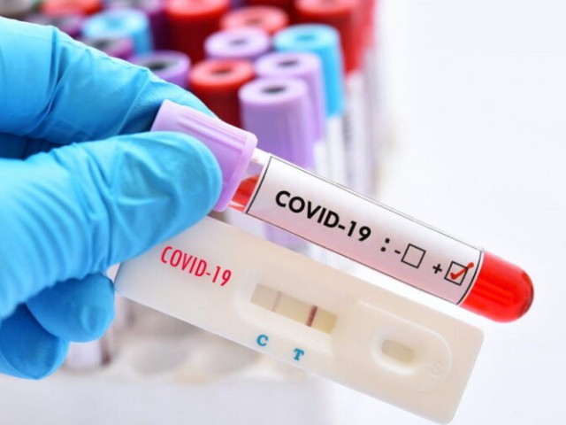 Κορονοϊός: 884 νέα κρούσματα, 25 θάνατοι, 326 διασωληνωμένοι