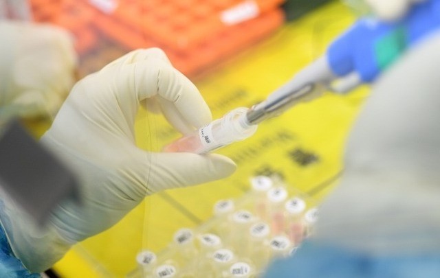 Δεκαπλάσια η θνησιμότητα από Covid-19 στις χώρες με υπέρβαρους
