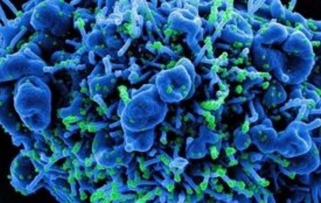 Καθηγητές ιατρικής συνοψίζουν τα βασικά στοιχεία του στελέχους «δέλτα»