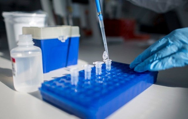 Η λοίμωξη από κορονοϊό μπορεί να επιφέρει και ενδοκρινικές επιπλοκές