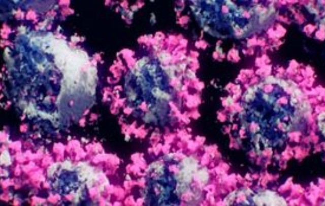 Τι ισχύει για την Delmicron και τη Florona