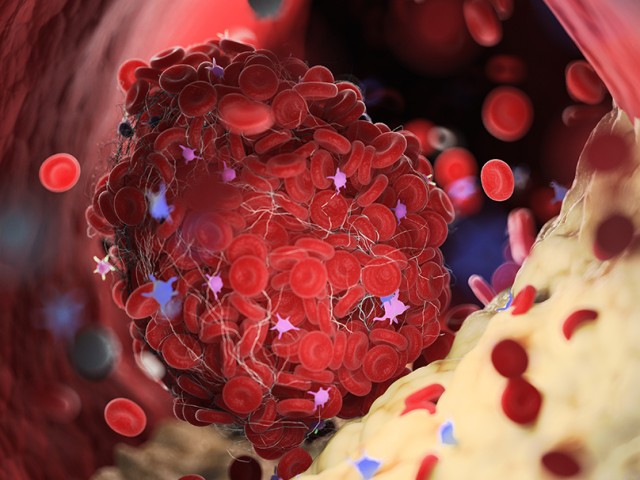 Διάγνωση των λιπιδίων που μπορεί να σώσει τη ζωή μας