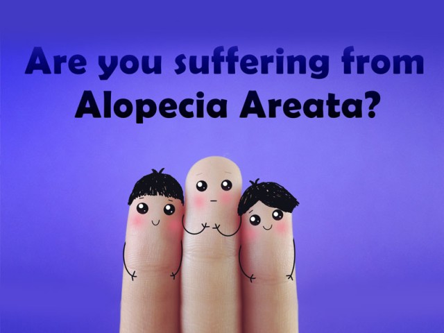 Γυροειδής αλωπεκία ή τριχοφάγος: Αίτια, συμπτώματα και αντιμετώπιση