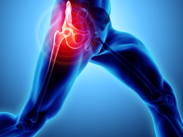 Τεχνική AMIS: Η πλέον φιλική προς τον ασθενή θεραπεία της οστεοαρθρίτιδας