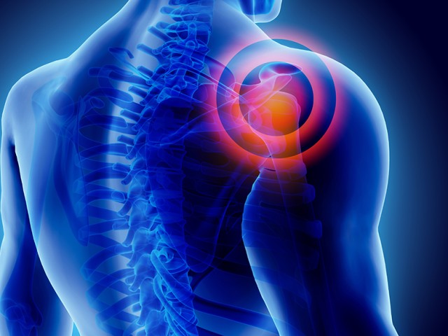 Ανάστροφη Ολική Αρθροπλαστική Ώμου