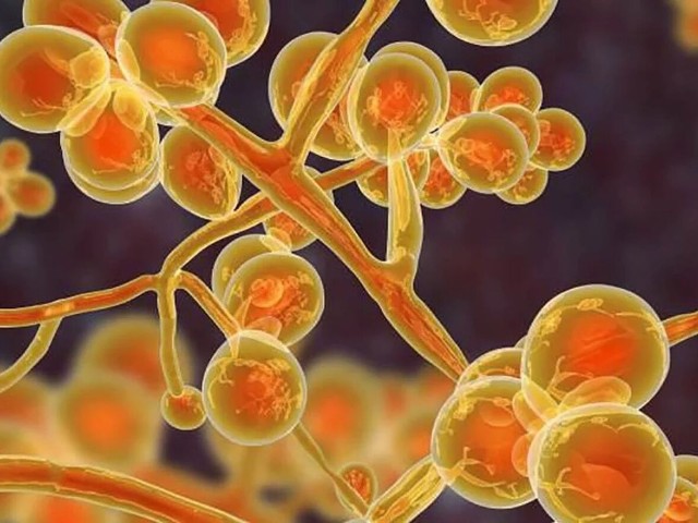 HΠΑ: Συναγερμός για την εξάπλωση του δυνητικά θανατηφόρου μύκητα Candida Auris σε 30 πολιτείες