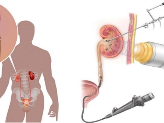 Εξετάσεις ελέγχου θυρεοειδούς σε ειδική τιμή από το Metropolitan General