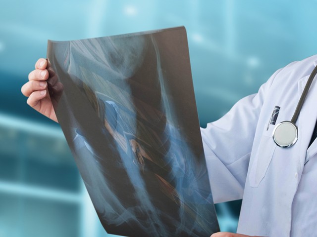 Πνευμονικός Όζος: Τι είναι και πώς αντιμετωπίζεται;