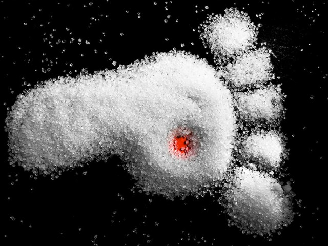 Διαβητικό Πόδι: Πρόληψη και θεραπεία