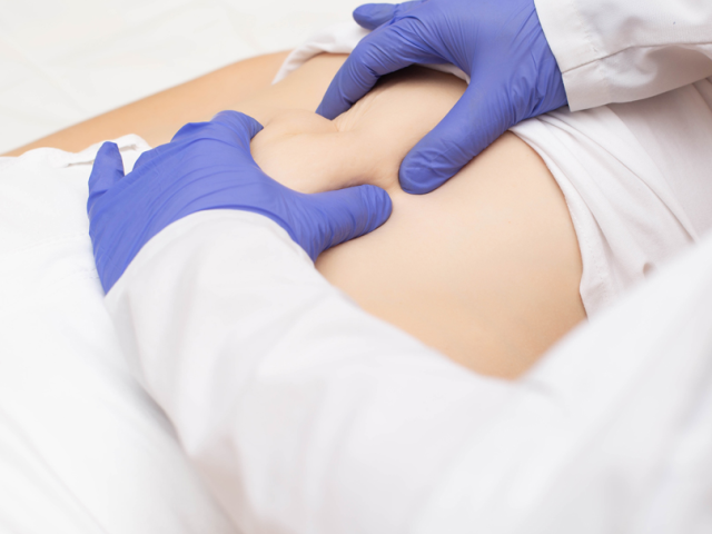 Βουβωνοκήλη: Συμπτώματα, κίνδυνοι και θεραπεία