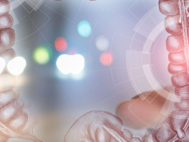 Εκκολπωμάτωση παχέος εντέρου: Παράγοντες κινδύνου και θεραπευτικές επιλογές