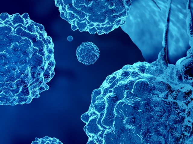 Μεταστατικός καρκίνος: Όταν δεν εντοπίζεται η αρχική εστία