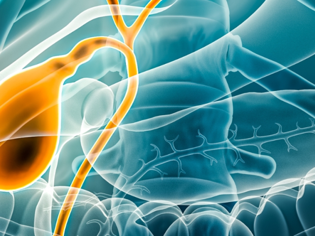 Χοληδόχος Κύστη και Πολύποδες: Διάγνωση και θεραπεία