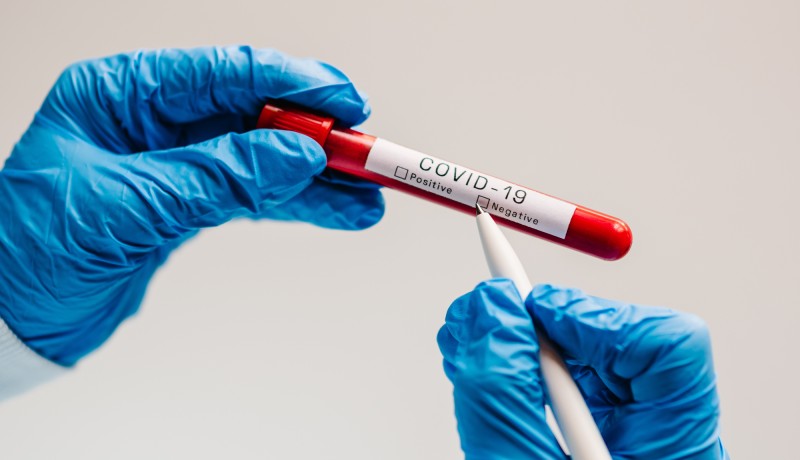 Covid-19 text. A hands of doctor, nurse, scientist writes with a pen and confirms the negative result, hold a test tube with biological sample. Coronavirus. Blood is dont infected. New cases of cure.