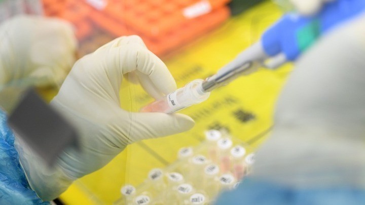 Δεκαπλάσια η θνησιμότητα από Covid-19 στις χώρες με υπέρβαρους