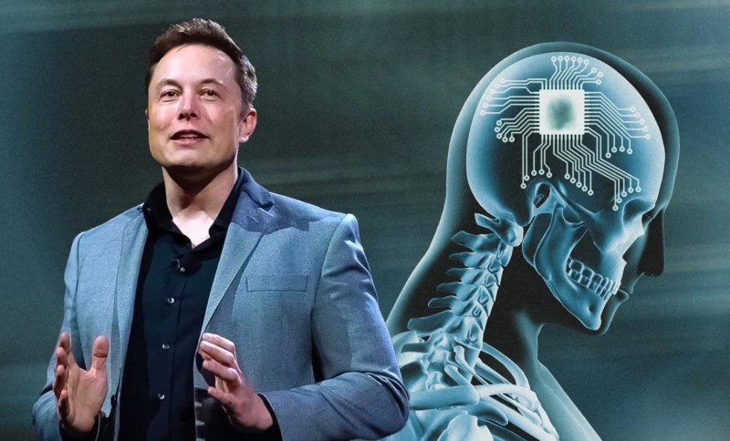 Elon Musk-Neuralink: Θα εμφυτεύσει υπολογιστές σε εγκεφάλους ανθρώπων – Τι θα κάνουν